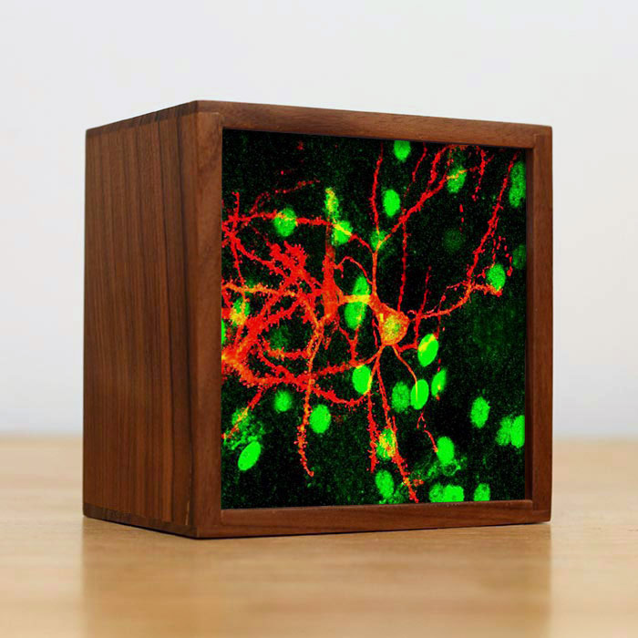 Image of a custom light box of a neural scan
