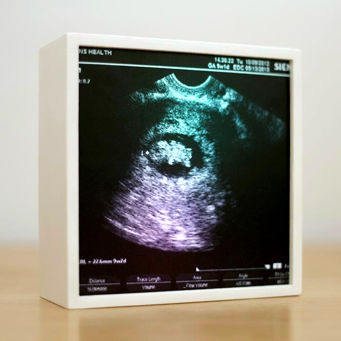 Picture of a custom light box of sonagram